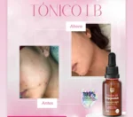 Tonico anti imperfecciones - Imagen 3